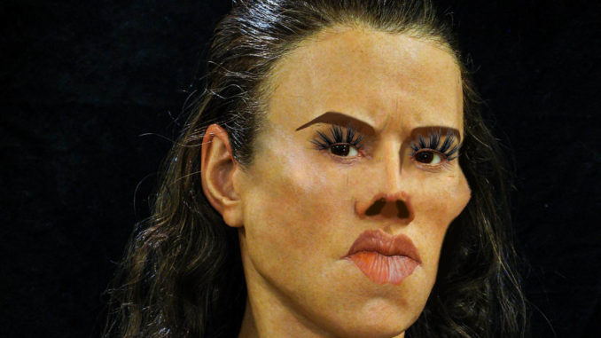 facial reconstruction 1